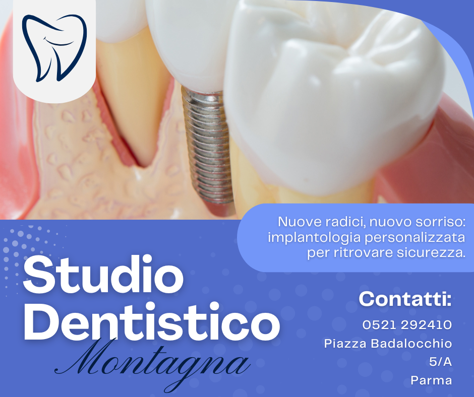 Implantologia – Radici Artificiali per Sorrisi Duraturi Implantologia – Radici Artificiali per Sorrisi Duraturi